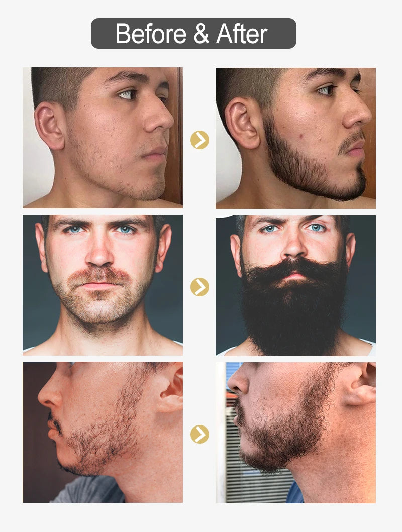 PURC Beard Oil for Men Nourishing Soften Beard Grooming Treatment Hair Oil Beard Care