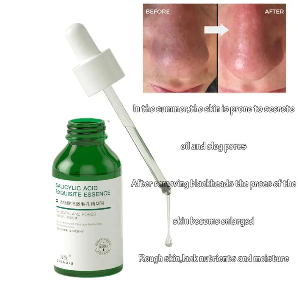 Salicylic Acid Pore Shrinking Essence Anti-acne Exfoliating Blackhead Remover Face Spot Removal Essence Beauty Health Skin Care