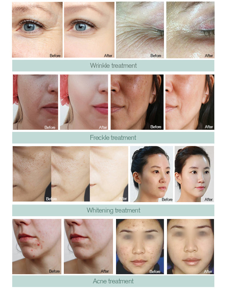Professional DEP Water Mesotherapy Injector Skin Hydration Machine Injection Gun Skin Lifting Tighten Whitening Device