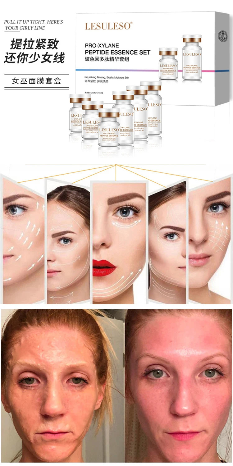 Lyophilized Powder Face Miracle Mask Korean Makeup Hiauluronic Acid Skin Tightening Stem Cell Solution Ampoule Salon Cosmetics