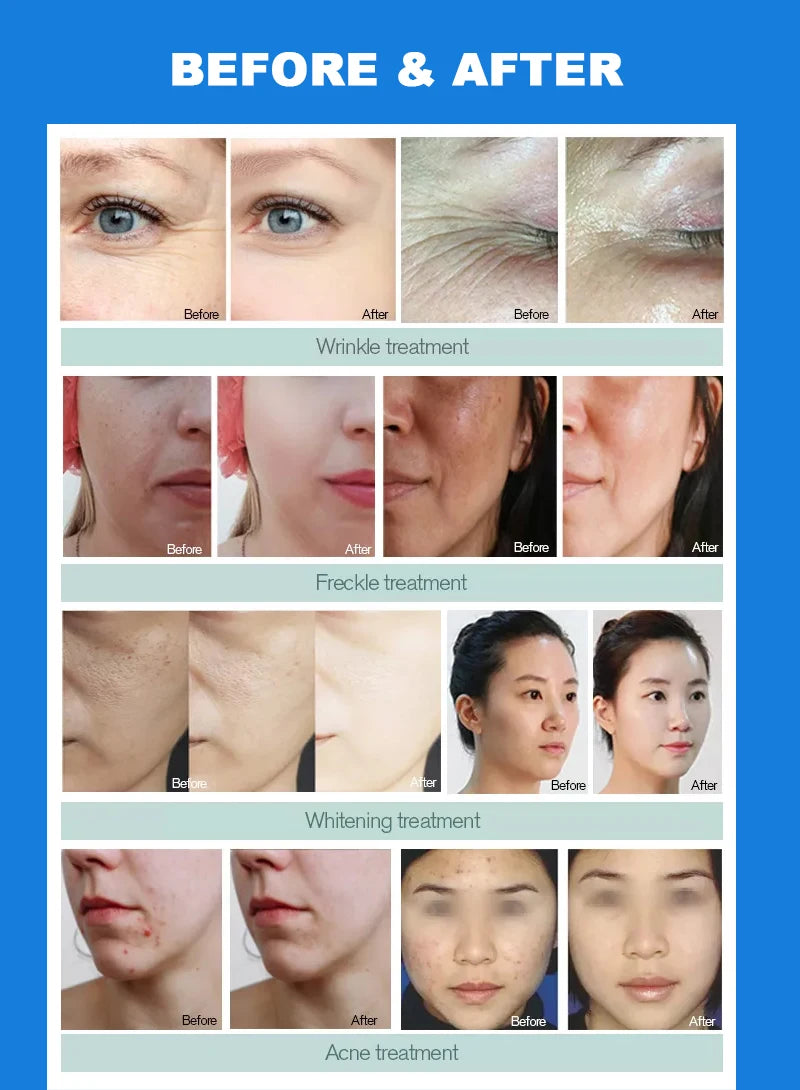 Professional DEP Water Mesotherapy Injector Skin Hydration Machine Injection Gun Skin Lifting Tighten Whitening Device