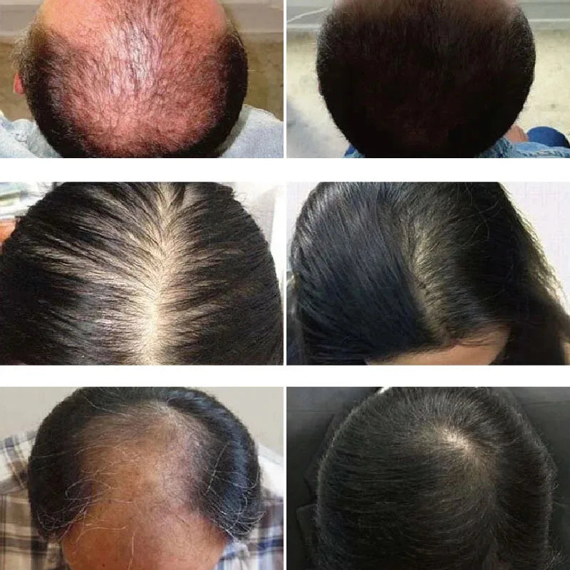 Powerful Hair Growth Serum Spray Regrowth Hair Anti Hair Loss Treatment Essence Repair Hair Nourish Root For Men Women Hair Care