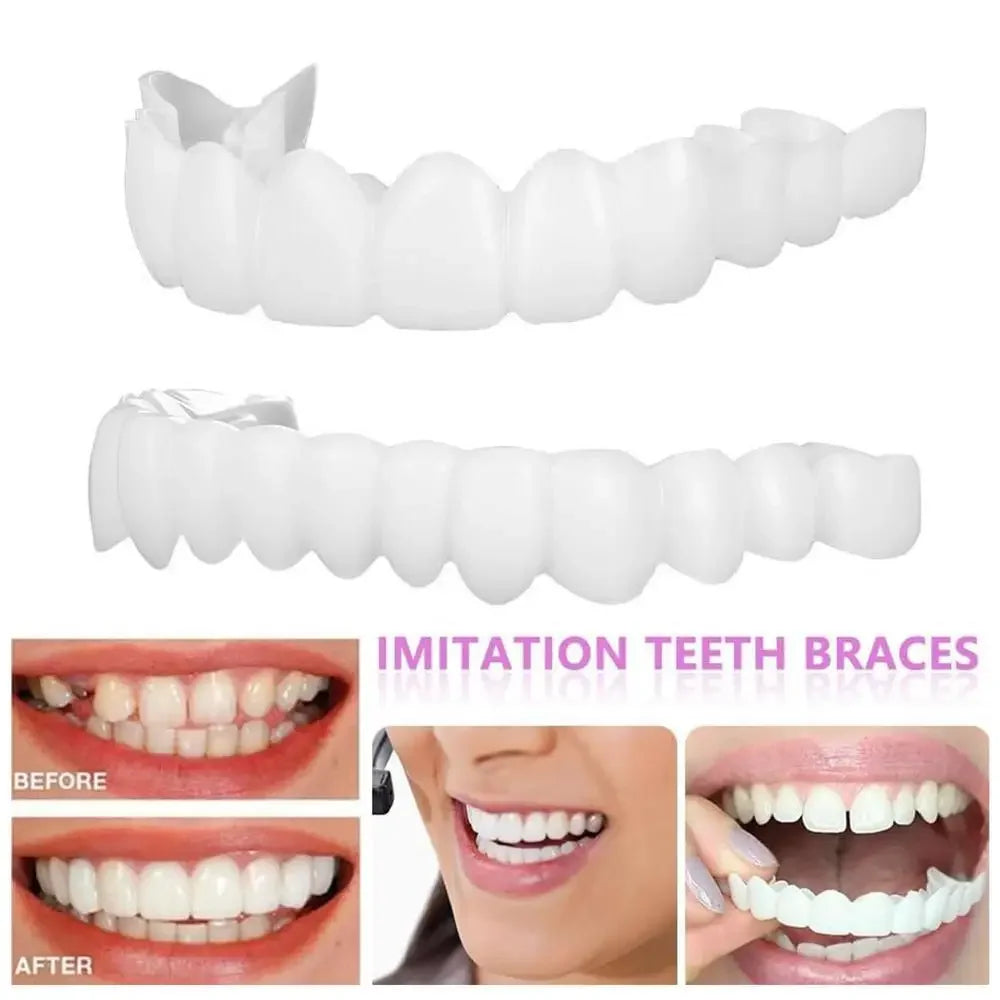 Sdatter Snap On Teeth Veneers Dentures For Men And Women Cover The Teeth Instant Confident Smile Temporary Teeth Oral Hygiene To
