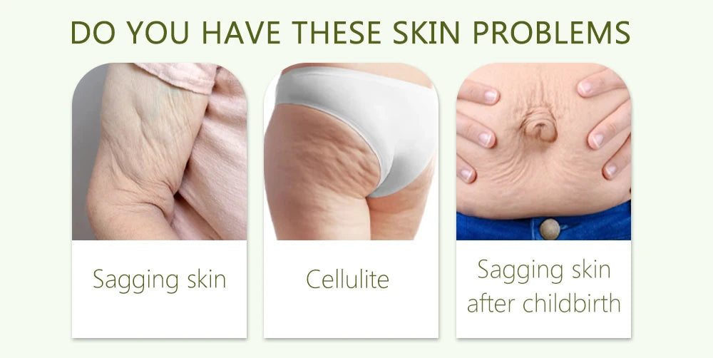 Retinol Postpartum Anti-Wrinkle Cream Anti-Aging Body Anti-Cellulite Care Improve Sagging Skin Repairing Firming Whitening Cream