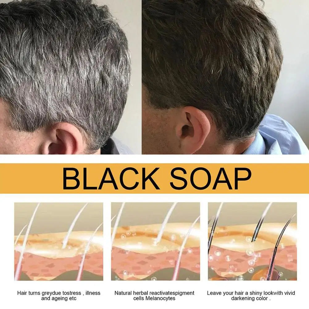 3PCS Hair Shampoo Soap Polygonum Multiflorum Shampoo Soaps Cover Gray Hair Shampoo Soap To Dye Canas Black Shampoo Bar Soap
