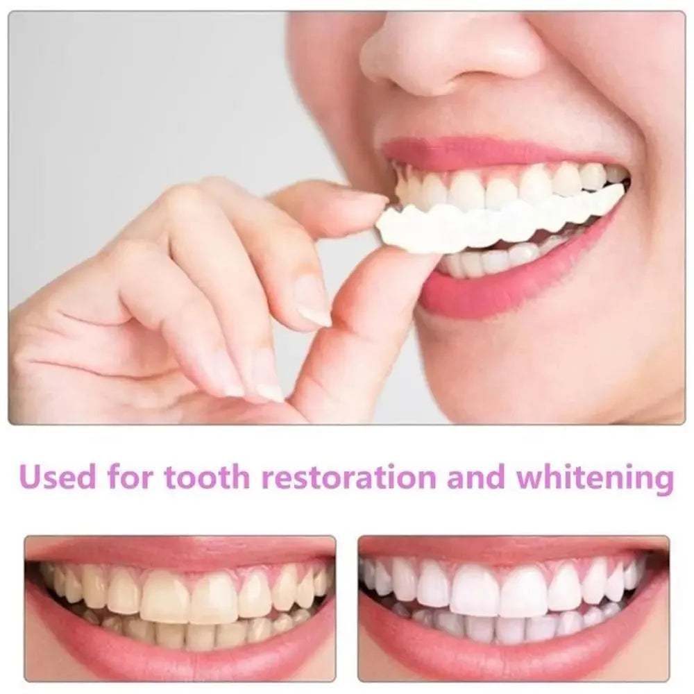 Sdatter Snap On Teeth Veneers Dentures For Men And Women Cover The Teeth Instant Confident Smile Temporary Teeth Oral Hygiene To