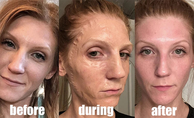 Lyophilized Powder Face Miracle Mask Korean Makeup Hiauluronic Acid Skin Tightening Stem Cell Solution Ampoule Salon Cosmetics