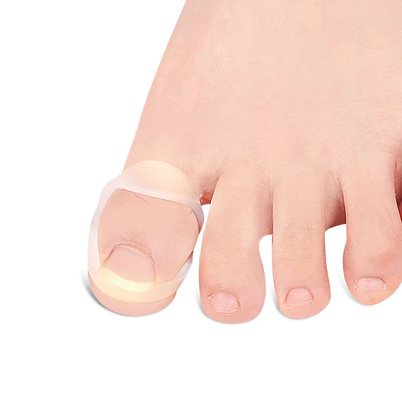 5Pcs Silicone Ingrown Correction Invisible Ingrown Toe Nail Elastic Straighter Clip Brace Pedicure Foot Care Protector