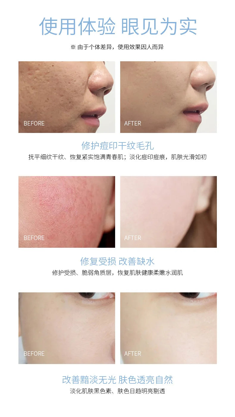Sheep Placenta Face Serum Oligopeptide-1 Acne Treatment Serum Face Freeze-Dried Powder Repair Anti-Wrinkle Liquid Facial Serum