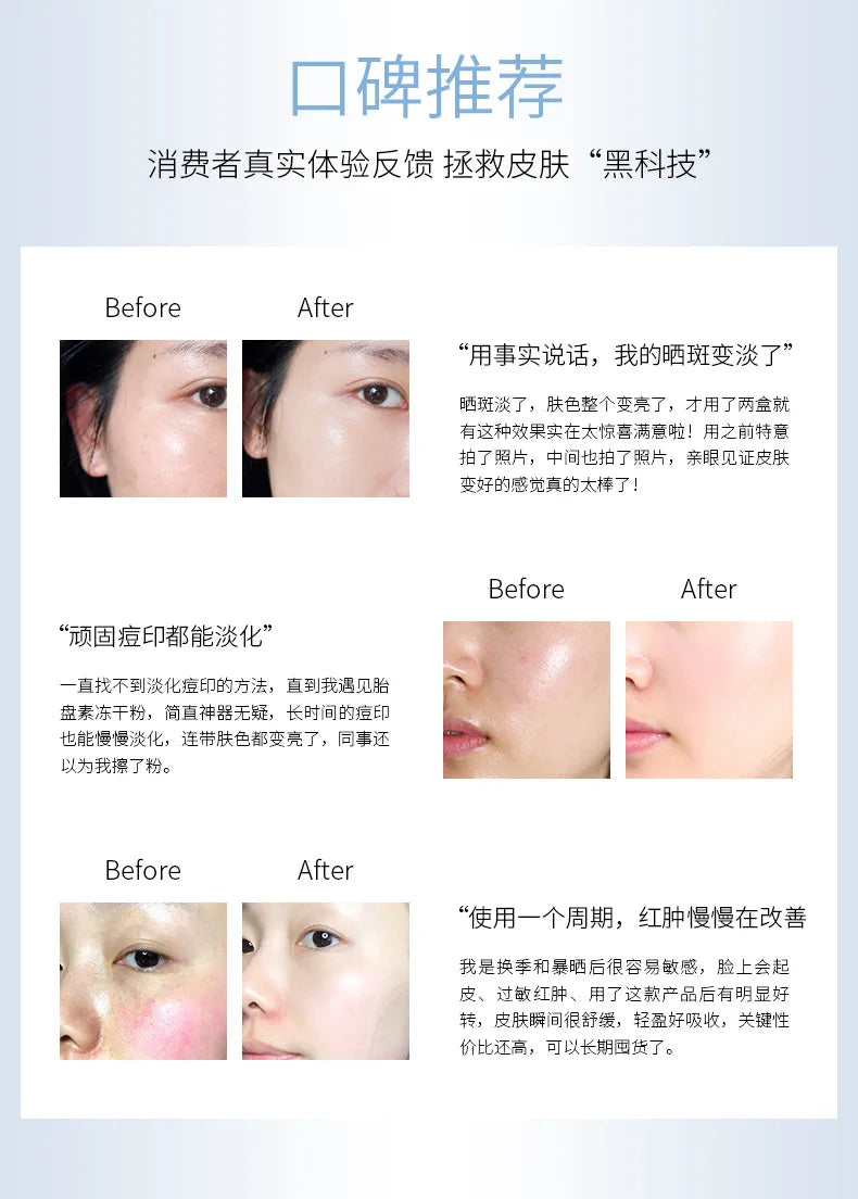 Sheep Placenta Face Serum Oligopeptide-1 Acne Treatment Serum Face Freeze-Dried Powder Repair Anti-Wrinkle Liquid Facial Serum