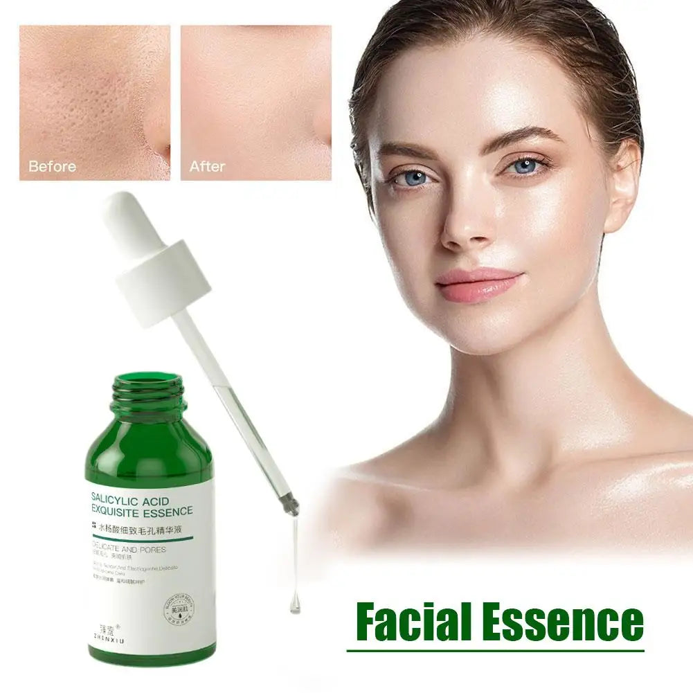 Salicylic Acid Pore Shrinking Essence Anti-acne Exfoliating Blackhead Remover Face Spot Removal Essence Beauty Health Skin Care