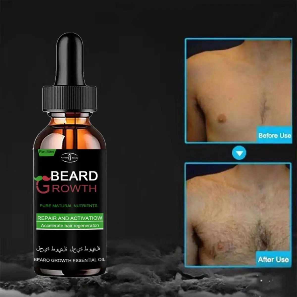 10ML TRSTAY Men Beard Growth Oil Fast Beard Growth Anti Alopecia Hair Loss Products