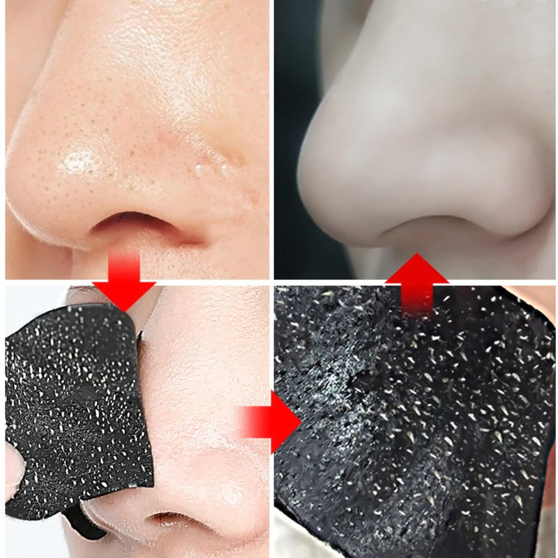 10/20/50pcs Nose Strips For Blackheads Acne Removal Instant Pore Unclogging Strips Deep Cleansing Nose Clean Patch New