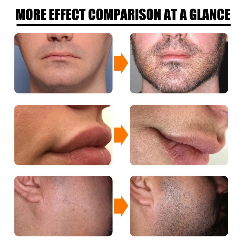 Beard Growth Essential Oil For Men Nourishing Repairing Moustache Thicker Beard Fast Growing Grooming Serum Products